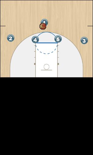 Basketball Play Elbows Zone Play zone offense